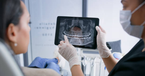 Licensed Wisdom Tooth Removal service in Marion, IL - Smile Center Dentistry
